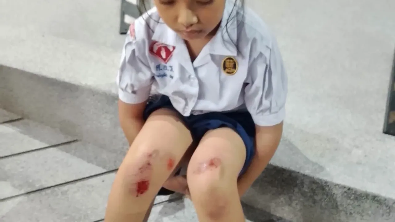 ตามล่าเก๋งขาวชนน้องปลายฝน ถนนชยางกูรช่วงเย็นวานนี้ ไร้ความรับผิดชอบหนีลอยนวล